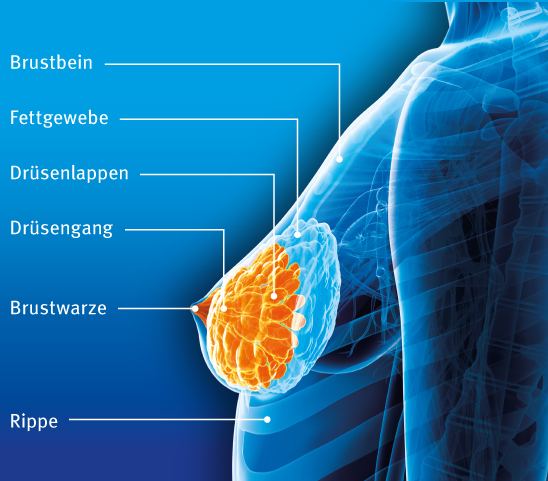 Gewebe in brust dichtes der Brustkrebs: Risikofaktor