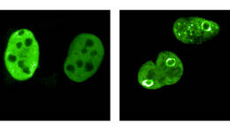 MYC-Proteine sind in dieser Abbildung grün gefärbt