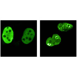 Proteinkugeln schützen das Genom von Krebszellen